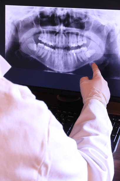 Best Emergency Gum Treatment in Farmington, MS